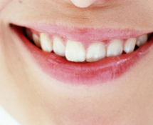 ホワイトニング・審美歯科